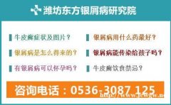 潍坊银屑病怎么治疗的最好潍坊东方