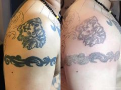 扬州纹身分享纹身后身体的恢复都需要过程什么，纹身多久可以恢复